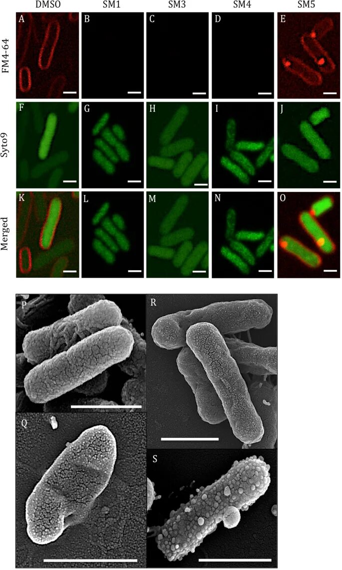 Salmonella enterica. Сальмонелла энтеридис. Salmonella Typhimurium микроскопия. Сальмонелла энтеритидис под микроскопом. Сальмонелла энтерика.