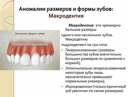 Неправильная форма зуба