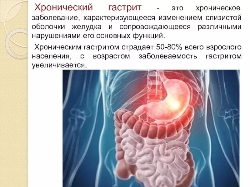 Хронический смешанный гастрит. Хронические заболевания желудка. Картина хронического гастрита