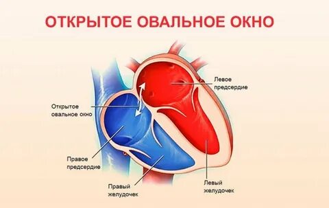 Овальное окошко у детей