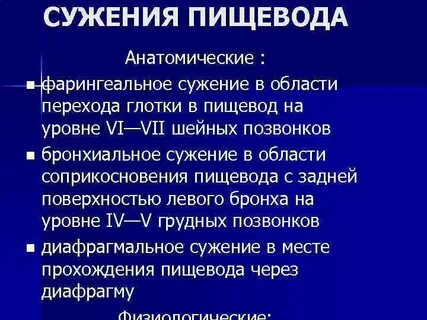 Сужения пищевода