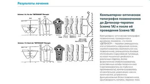 Оптическая топография