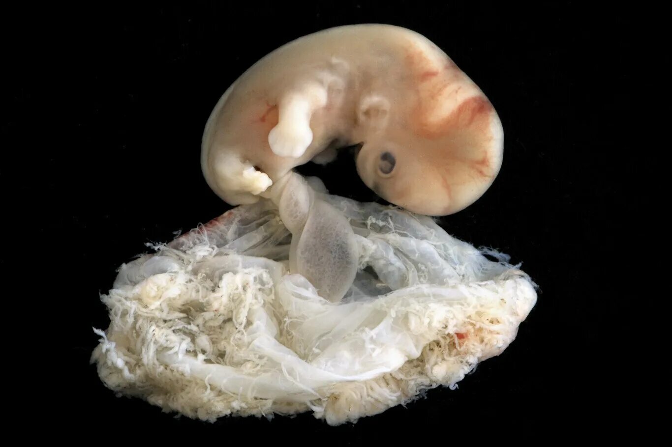 Зародыш 6-7 недель беременности. Человеческий эмбрион 7 недель. 6 недель беременности что происходит с мамой