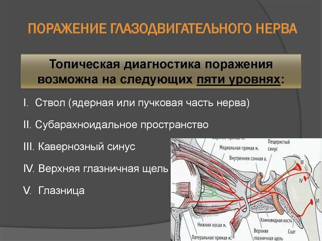 Глазодвигательный нерв неврология схема. Клиника поражения глазодвигательного нерва. Глазодвигательный нерв (III пара черепных нервов). Глазодвигательный нерв путь схема нейронов. Ишемия нерва