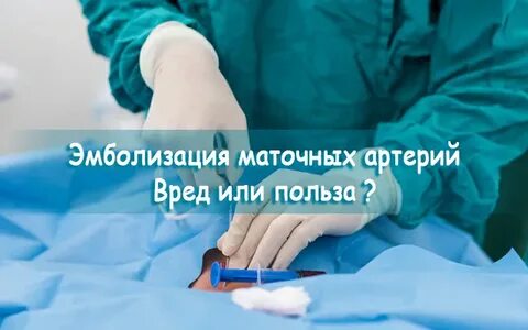 Миома артерии
