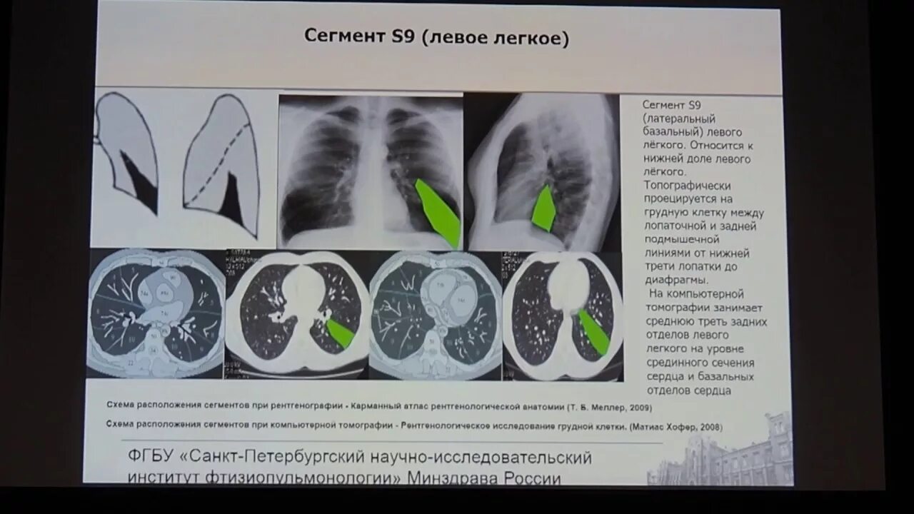 Pin su Anatomia