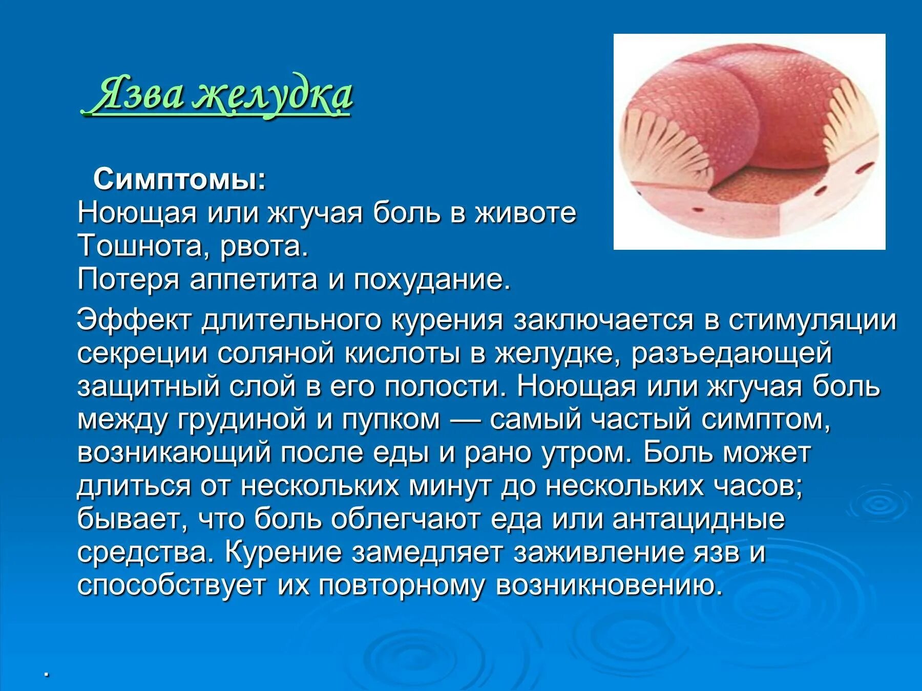 Возникновение язвы желудка. Симптомы язвенной болезни. Язвенная болезнь желудка симптомы.