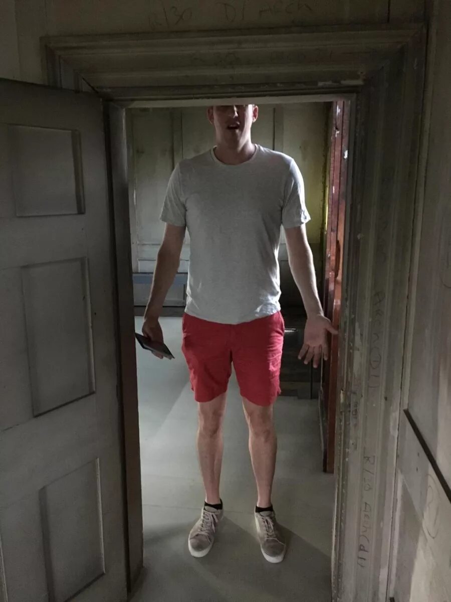 карликовость гигантизм акромегалия. эстетика высоких людей. самый высокий человек в мире рост 2022. форумы высоких людей. рост 2 метра.