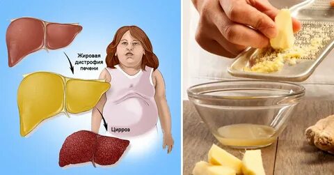 Выводит жир из печени
