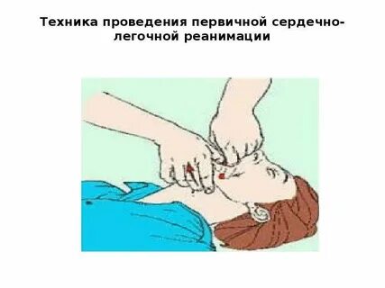 Пальцы при сердечно легочной реанимации