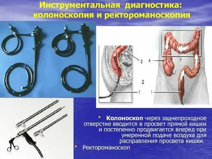 Ректороманоскопия и колоноскопия в чем отличие