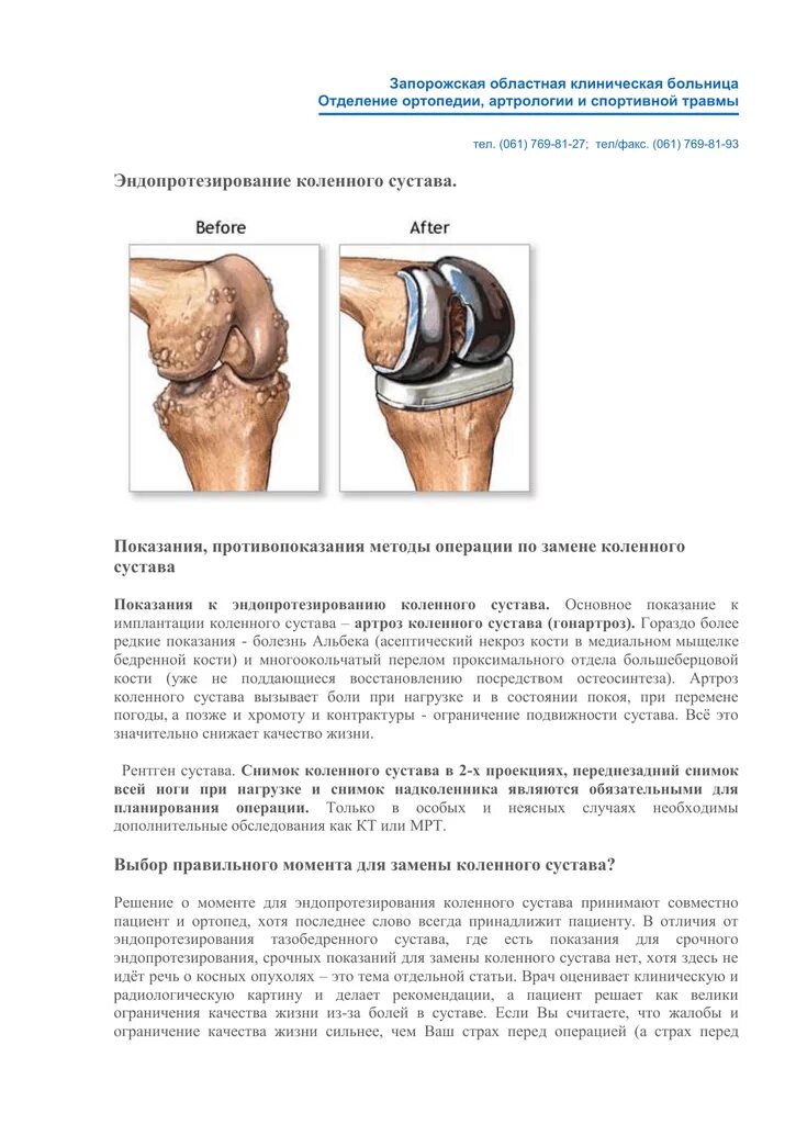 Эндопротезирование отзывы пациентов после операции. Эндопротезирование коленного сустава. Операция тотального эндопротезирования коленного сустава. ТЭП эндопротезирование коленного сустава. Тотальное эндопротезирование коленного сустава схема операции.