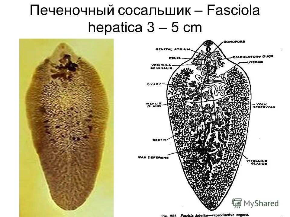 Марита трематоды. Марита Fasciola hepatica строение. Печеночный сосальщик (Fasciola hepatica). Сосальщик какой тип