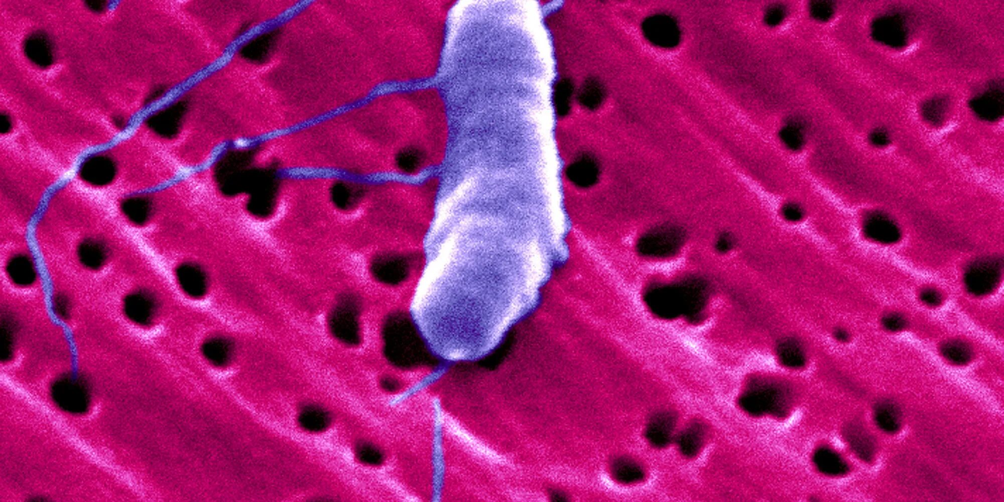 Vibrio Плотоядная бактерия. Плотоядные бактерии бактерии.