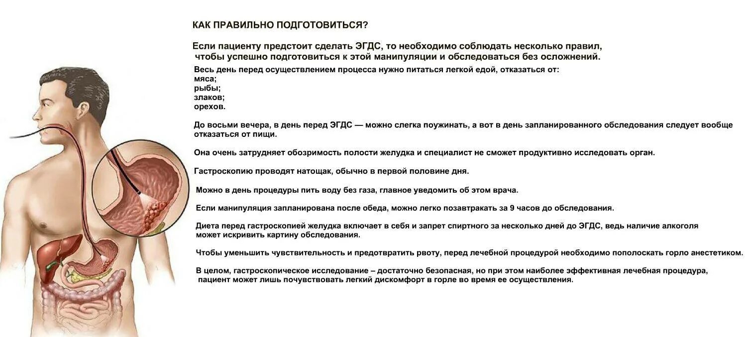 ФГДС порядок проведения процедуры. Памятка пациенту перед ФГДС. Памятка для пациента по подготовке к ФГДС. Подготовка и проведение фиброгастроскопии.