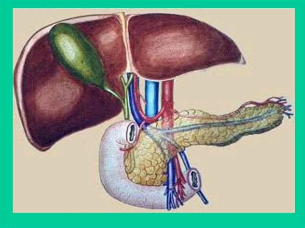 Печень без желчного пузыря. Билиарный тракт анатомия. Желчнокаменная болезнь анатомия. Холецистит анатомия желчного пузыря.