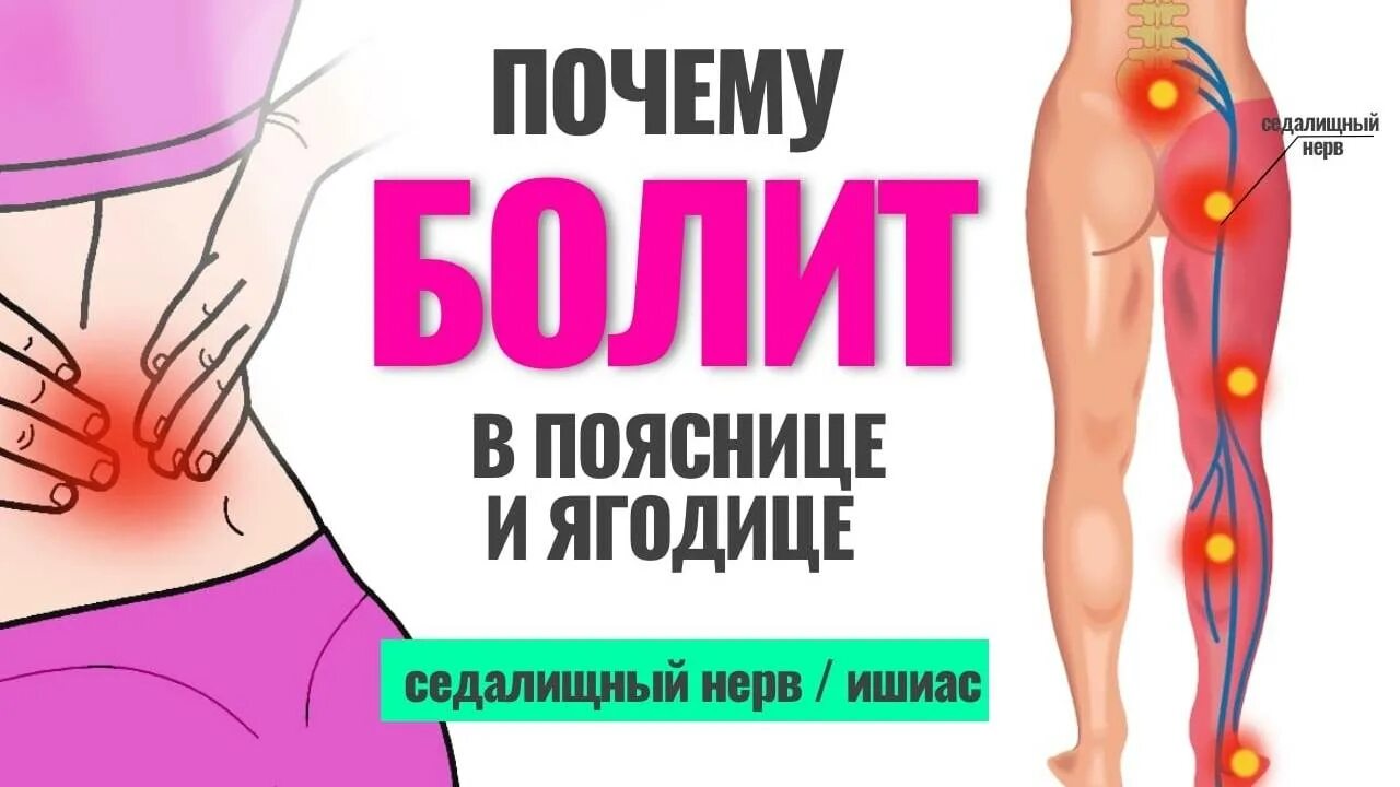 Боль в пояснице и ягодице слева. Болит седалищный нерв в ягодице. седалищный нерв причины. седалищный нерв симптомы у женщин. защемление седалищного нерва у женщин.