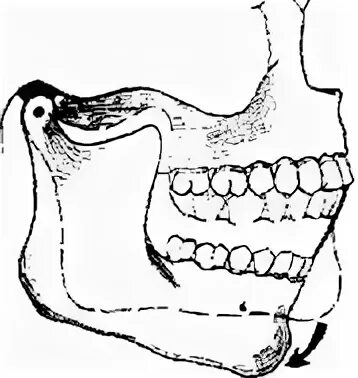 Мыщелки челюсти. Вспомогательная модель нижней челюсти. Угол головки мыщелка нижней челюсти. Измерение импульса при движении челюсти.