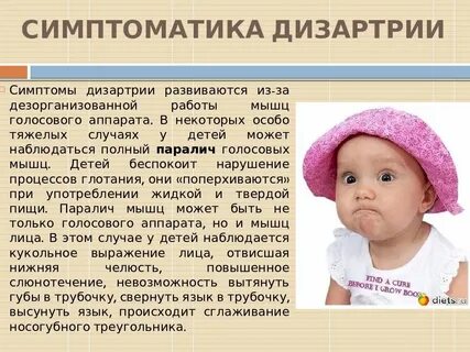 Синдром дизартрии