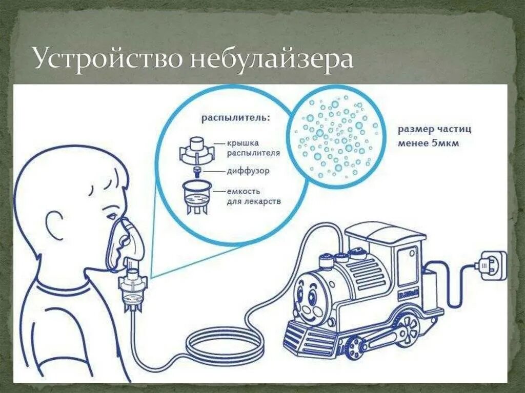 Алгоритм проведения ингаляций небулайзером. Алгоритм проведения ингаляции небулайзер. схема использования ингаляции с небулайзером. проведение ингаляций через ингалятор небулайзер алгоритм. небулайзер схема.