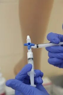 Способ введения склерозанта для остановки