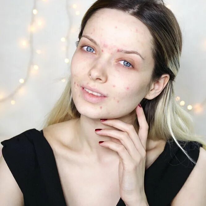 Люди с недостатками 2