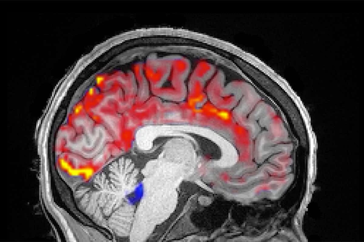 Sleeping brains