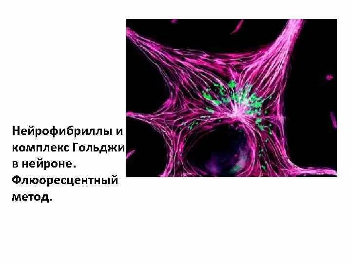 Нейрофибриллы функции. Нейрофибриллы спинного мозга собаки. нейрофибриллы нейрона. нейрофибриллы в клетках спинного мозга. строение нейрона нейрофибриллы.