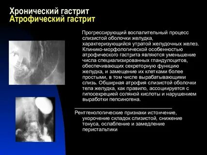 Морфологические признаки желудка