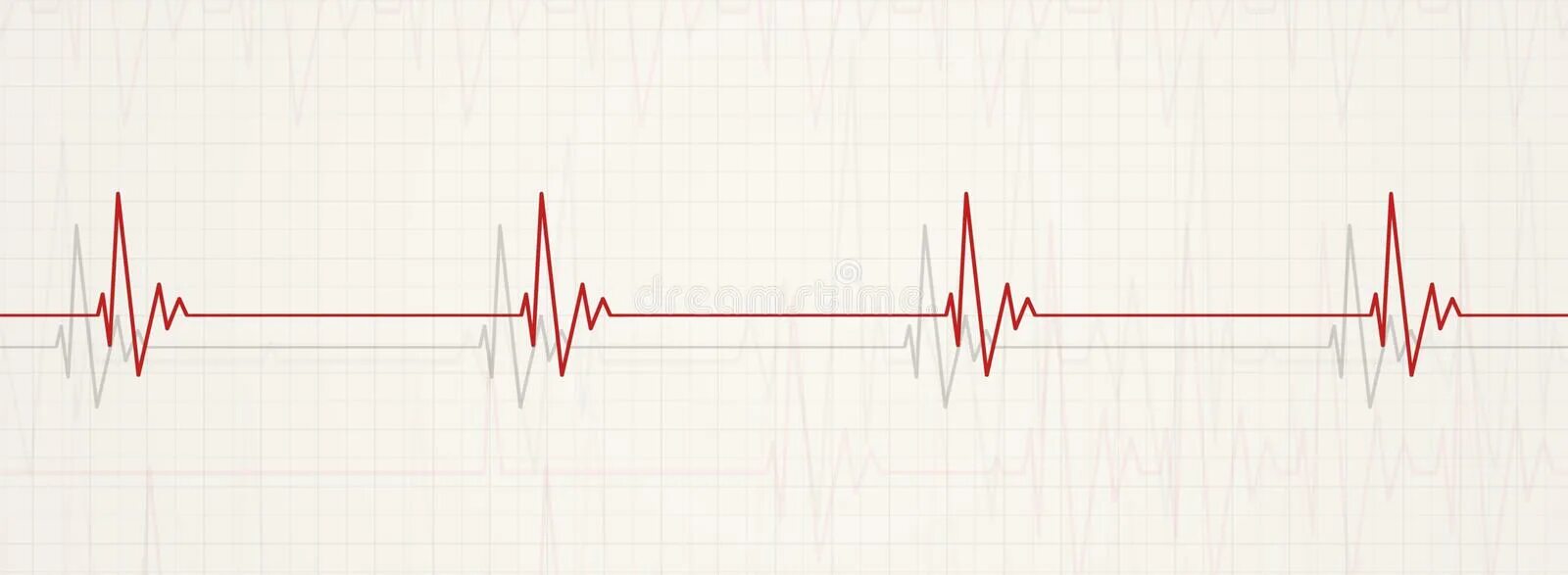 Beat per minute png. Картодиаграмма сердца. Учащение пульса. Кардиология фон. Учащение чсс.