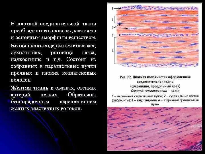 Плотная оформленная ткань. Состав плотной неоформленной соединительной ткани. Клетки плотной неоформленной соединительной ткани. Плотная оформленная соединительная ткань с эластическими волокнами. Плотная неоформленная соединительная ткань.