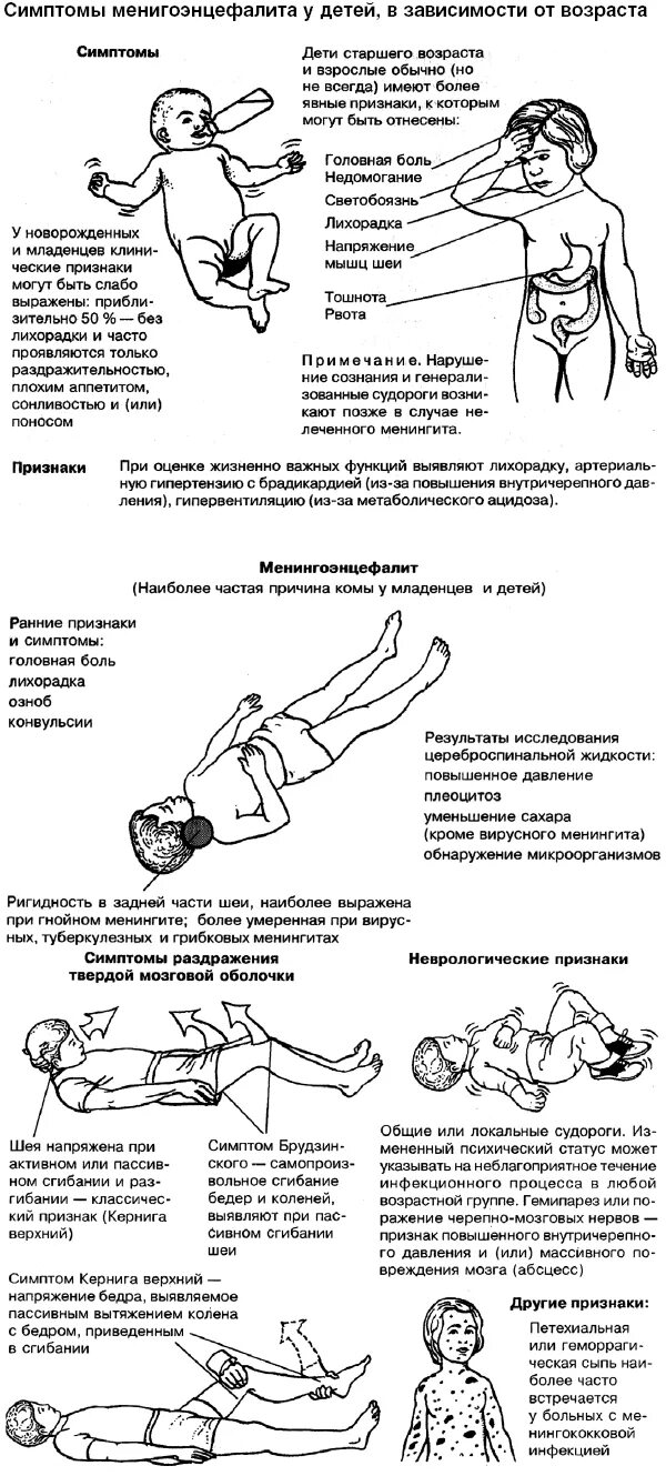 Тест на менингит. Менингеальные симптомы у грудничков. Менингит у грудничка симптомы. Менингит симптомы у детей до 2 лет.