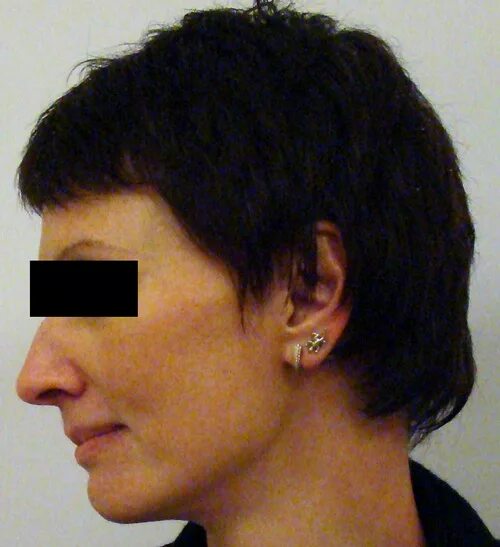 кулиев теймур арифович пластический хирург