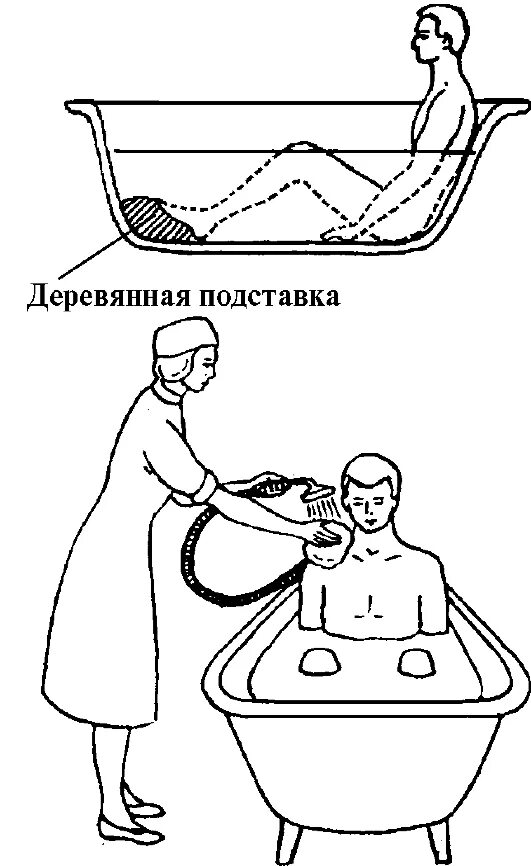 Проведение гигиенической ванны пациенту. Проведение гигиенических ванн тяжелобольным. Санитарная обработка тяжелобольных пациентов. Санитарно-гигиеническая обработка пациента схема. Ванна ребенка алгоритм