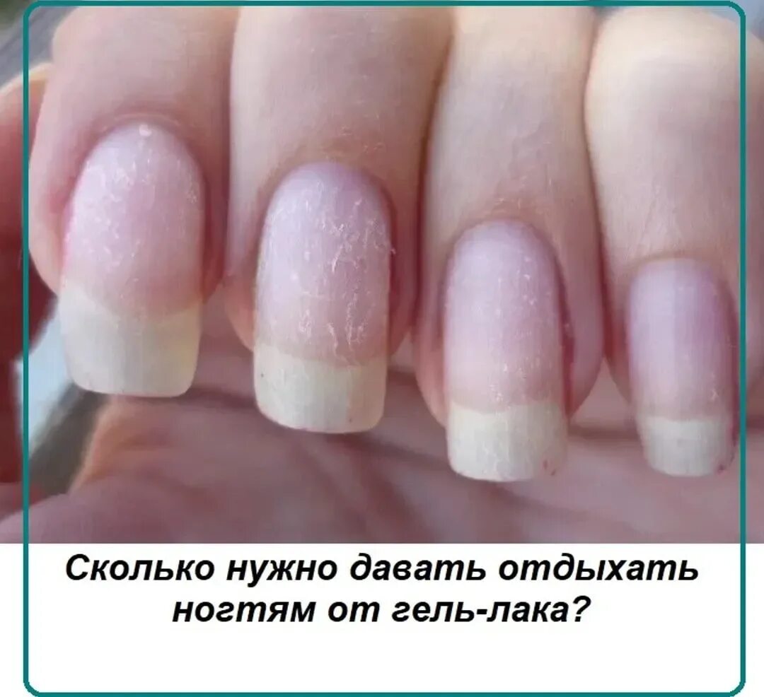 Ногти после снятия гель