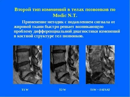 Модик 1 типа