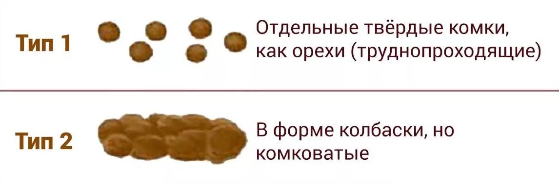 Каловая пробка как сходить в туалет. Препараты для размягчения стула. Каловая пробка как сходить в туалет. Массажьживота при щапорах. Правильная поза при дефекации.