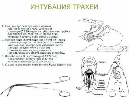 Интубация манипуляция