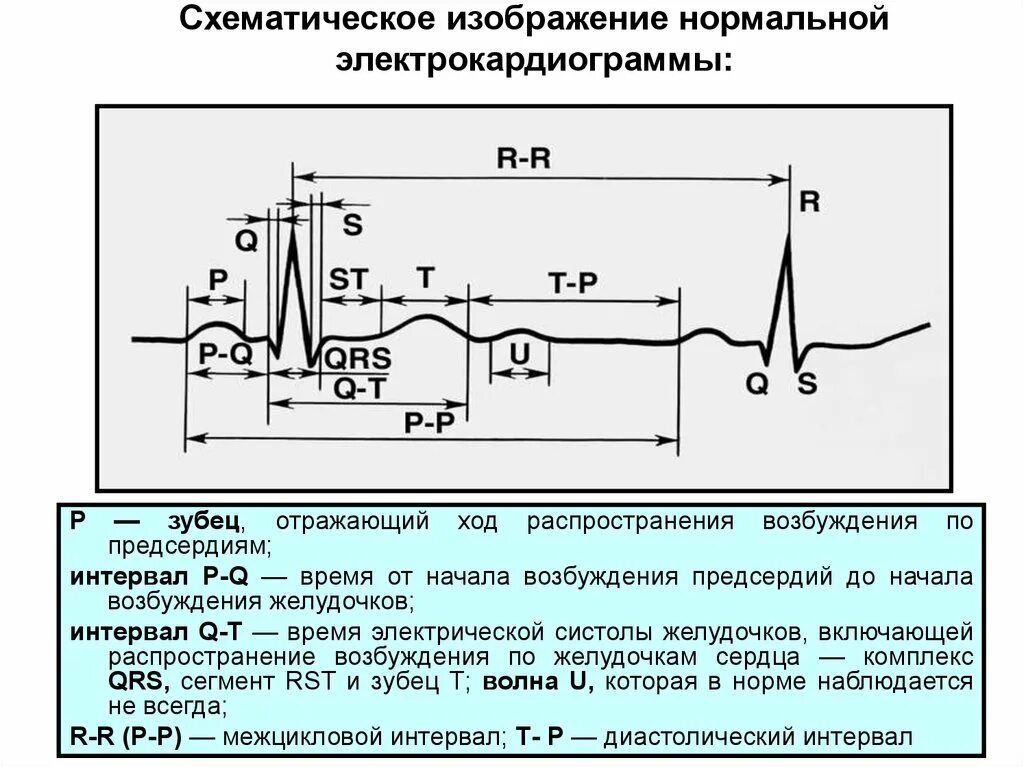 Нормальные показатели зубцов и интервалов ЭКГ. ЭКГ схема зубцы интервалы. Электрокардиография анализ электрокардиограммы. Зубцы интервалы и сегменты ЭКГ норма. В каких условиях необходимо проводить исследование экг