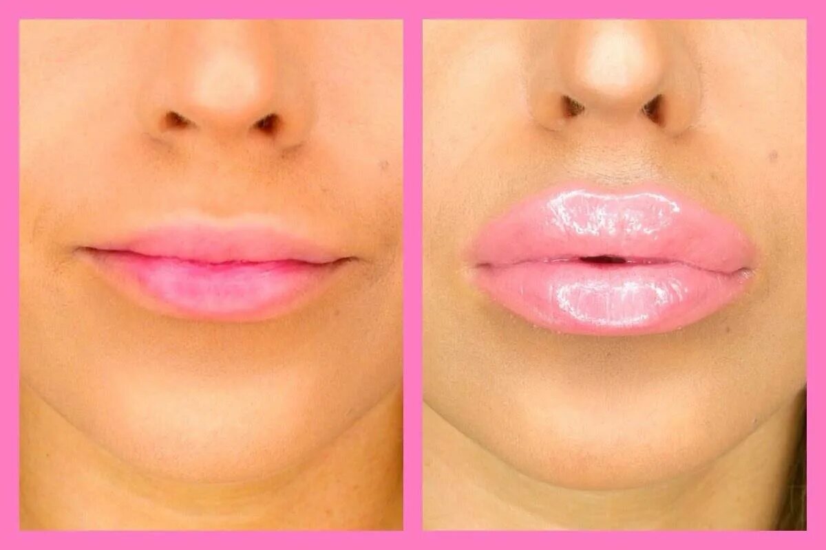 Собранные губы. Красивая форма губ. Красиво увеличенные губы. Форма губ для увеличения.