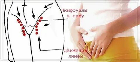 Увеличились лимфоузлы в паху у женщин