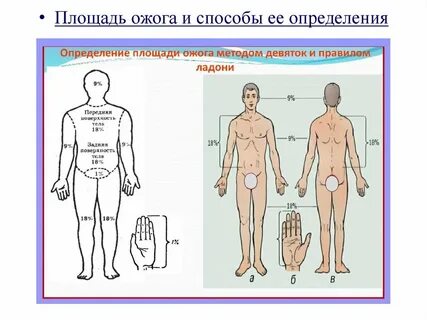 По правилу девяток передняя поверхность туловища составляет