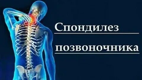 Упражнения спондилоартроза поясничного отдела позвоночника
