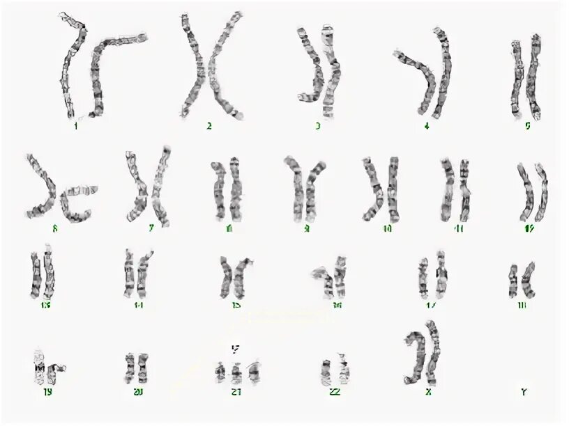 21 Хромосома. 21 И 22 хромосомы. 21 Хромосома как выглядит. 21 Хромосома кулон. 21 means