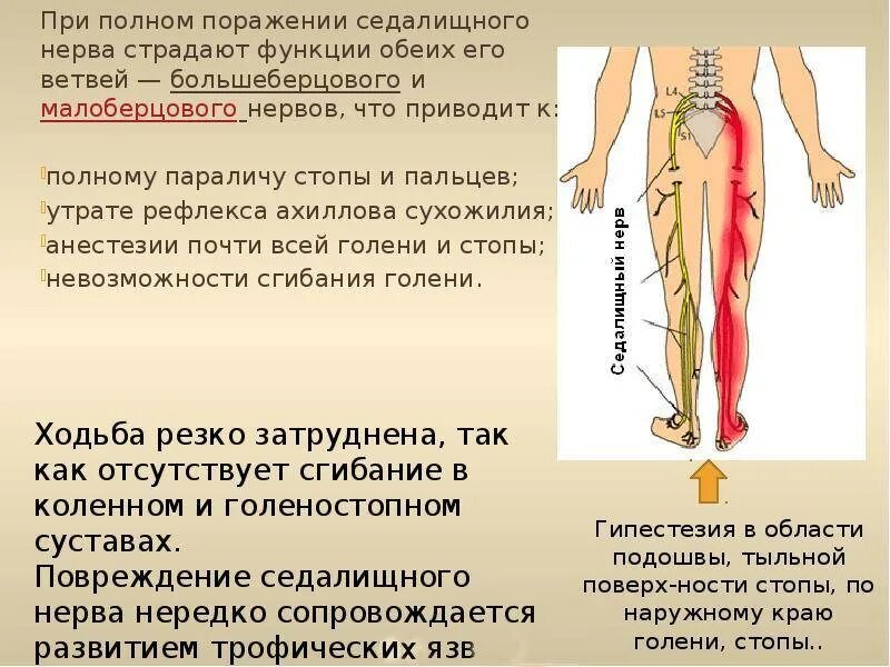 В каких местах происходит