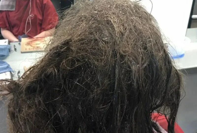 Колтуны у человека на длинных волосах. Длинные запутанные волосы. Запутанные волосы на голове. Как распутать сильный колтун на волосах. Колтун волос на голове.