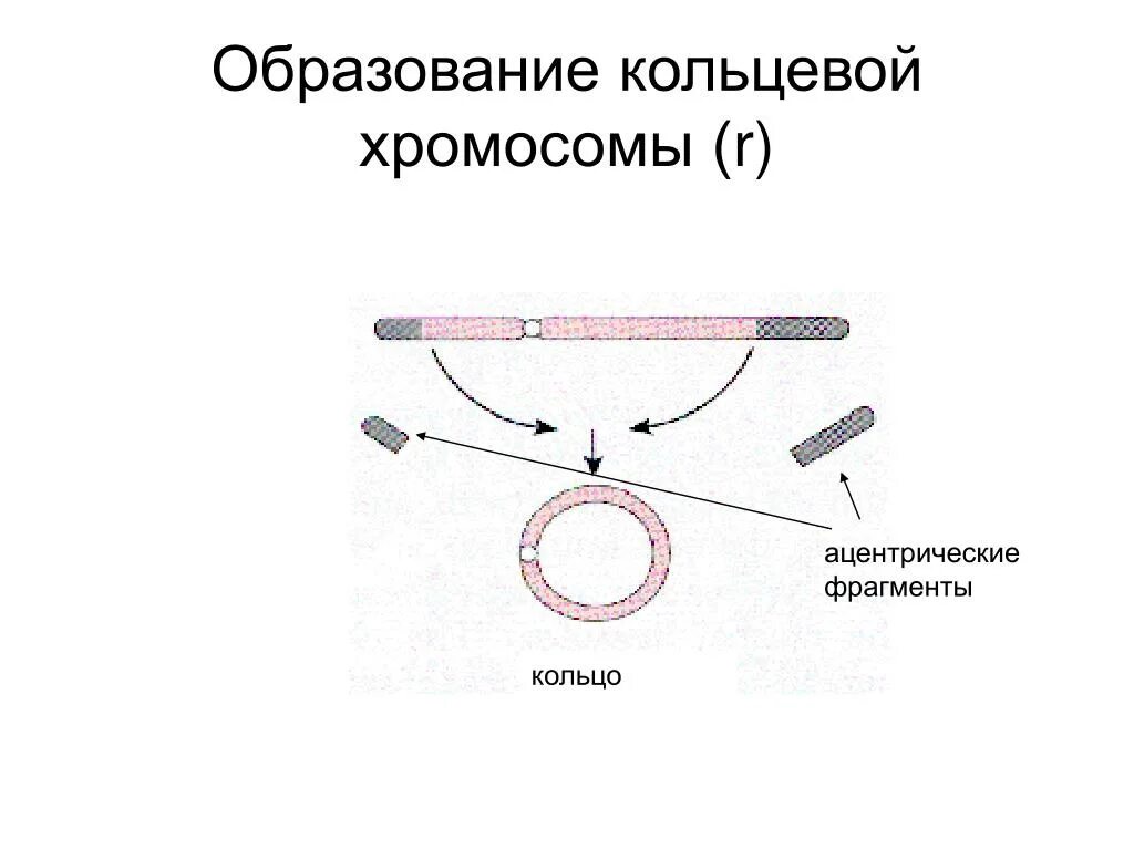 Кольцевая хромосома. Возникновение кольцевых хромосом. Ацентрическая Кольцевая хромосома. Образование кольцевой хромосомы. Кольцевая 4 хромосома