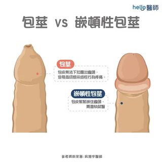 2. 嵌 頓 性 包 莖 