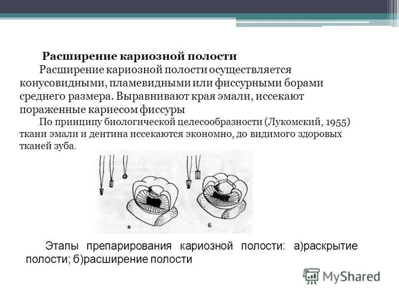 Классификация кариозных полостей по блэку. Классификация кариозных полостей по блэку
