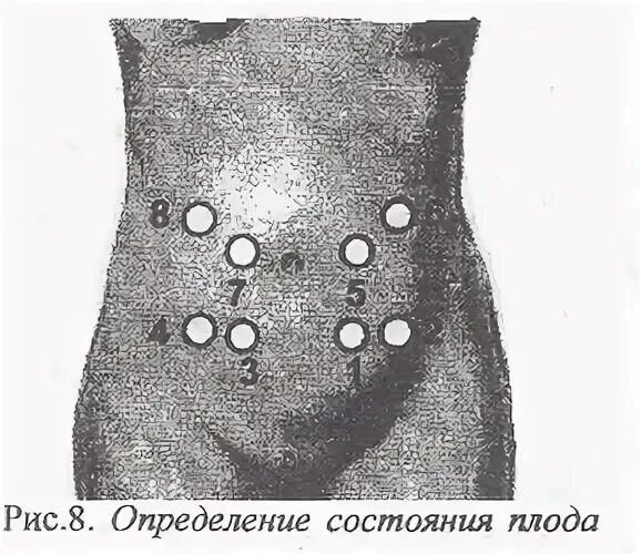 Сердцебиение плода через стетоскоп. Сердцебиение плода. Фетальный допплер в жк. Аускультация сердцебиения плода. Выслушивание сердцебиения плода алгоритм.